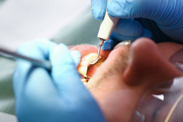 Best Tooth Pain Emergency Relief  in Madison, SD