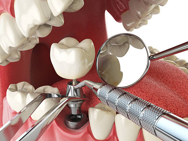 Emergency Dentist Open Today in SD